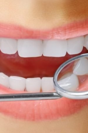 WHAT ARE THE PROS AND CONS OF CEREC CROWNS?