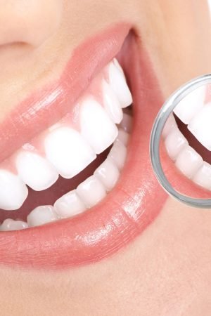 Why is it Important to Get Your Teeth Cleaned?
