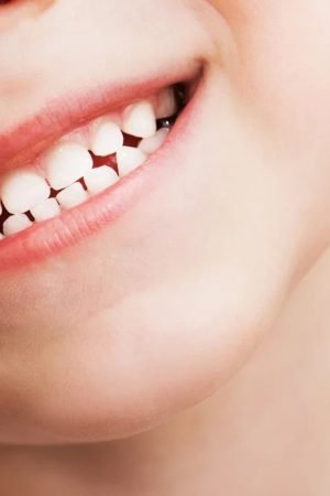 5 Foods to Strengthen Teeth