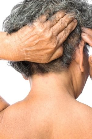 The Scalp Sore Options As Per the Requirement Now