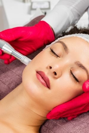 Rejuvenate Your Face with the Fine Thread Lifting Treatment