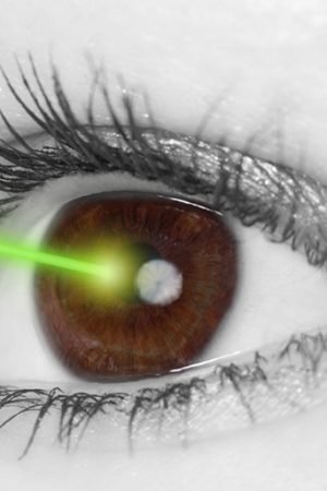 What is the benefit of having LASIK eye surgery?