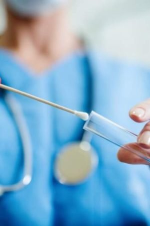 How To Perform Chlamydia Tests