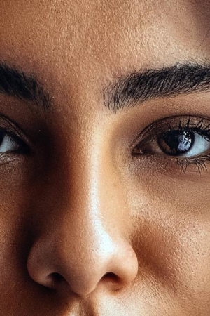 Reasons of Having Asymmetrical eyes