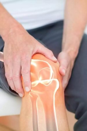 Causes And Risk Factors For Knee Arthrosis