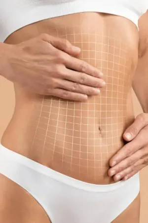The Ultimate Guide to Liposuction: Transform Your Body with Confidence