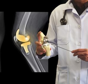 Orthopedic Implants and Infection Control: Best Practices