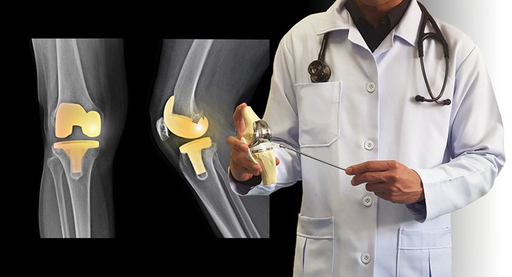 Orthopedic Implants and Infection Control: Best Practices